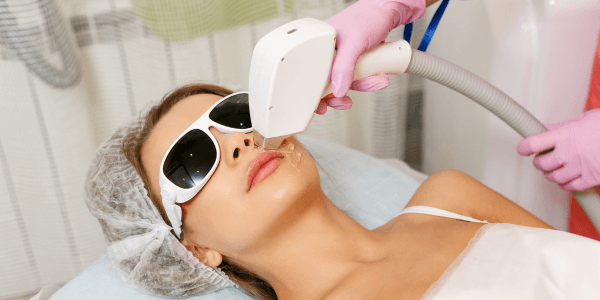 Face Laser hair Removal in Gurgaon