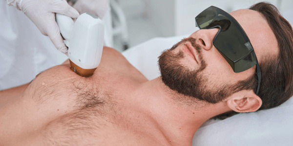 Upper Body hair removal