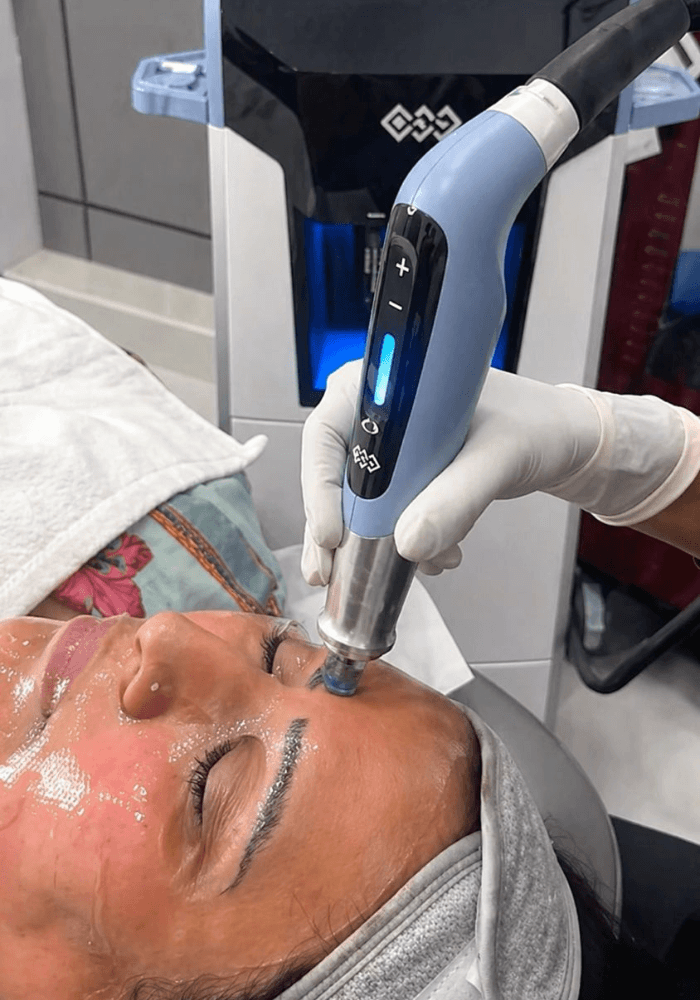Emfusion Facial