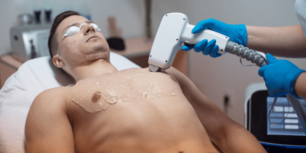 Upper Body Laser Hair Removal